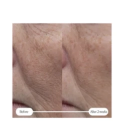 Elemis Pro-Collagen Rose Marine Cream -Nursing Store Pro Collagen Rose Marine Cream add2 71339 6158 general